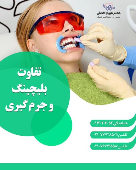 تفاوت بلیچینگ دندان با جرم گیری دندان ؟!