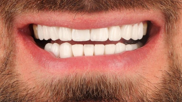 تکنولوژی های جدید در دندان پزشکی زیبایی