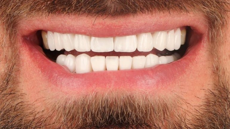 تکنولوژی های جدید در دندان پزشکی زیبایی