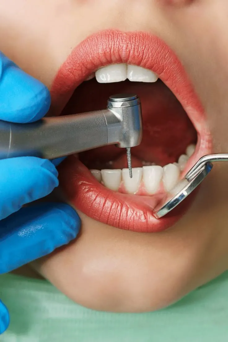 مراقبت های قبل و بعد از جراحی دندان